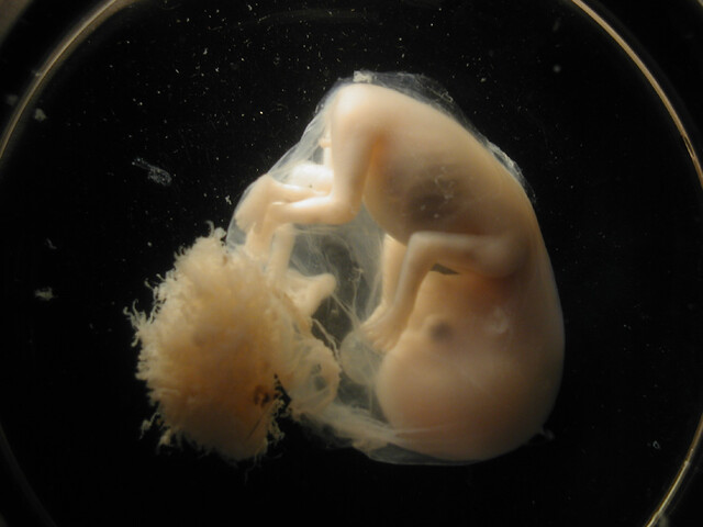 Override of the title embryo