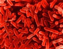 Override of the title Foto legionella-bacterie